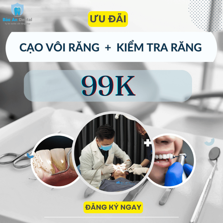 Combo Cạo Vôi Vệ Sinh Răng 99k